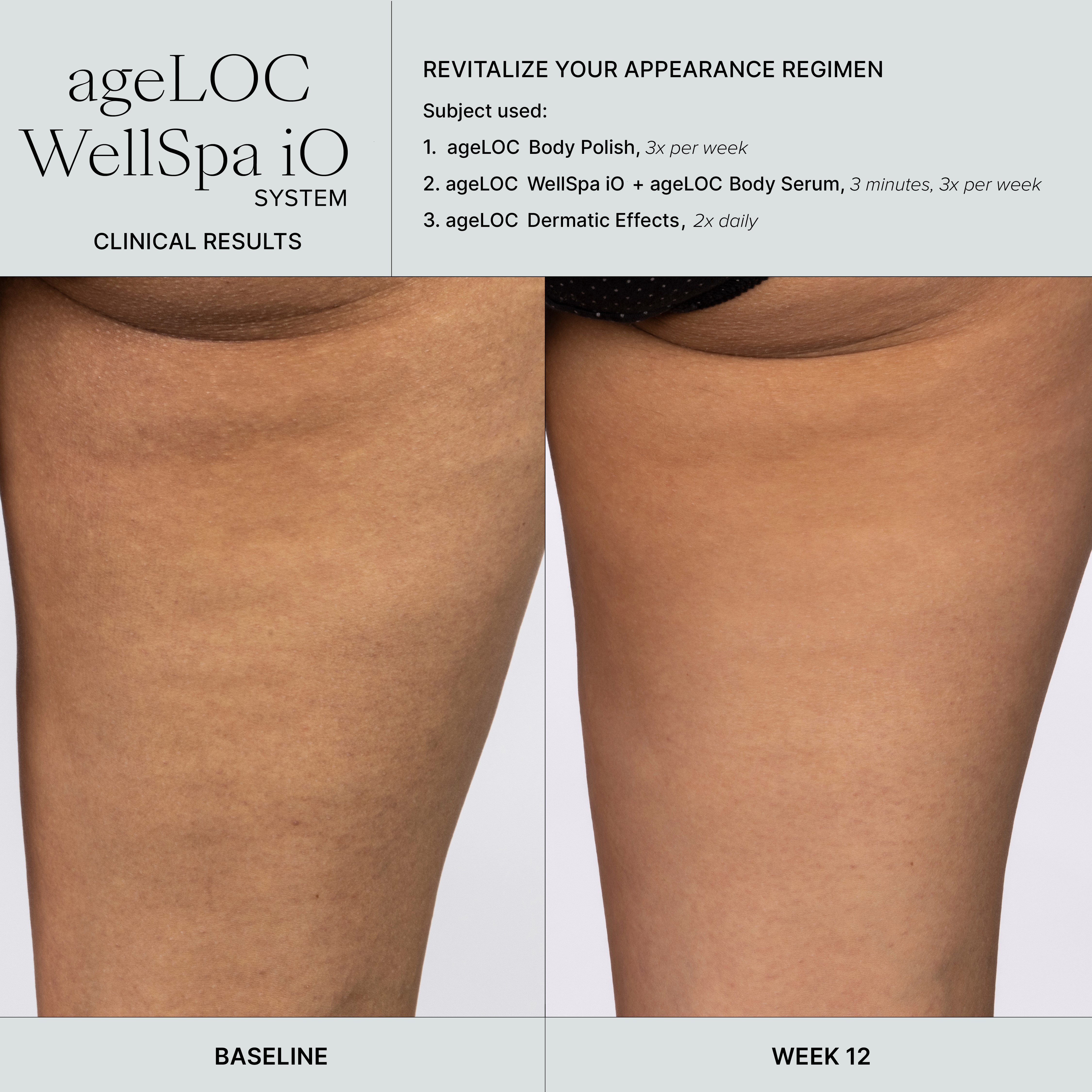 WellSpa iO before after 3min 3x tigh 2